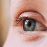 Eyelid Surgery (Blepharoplasty): The Secret to Brighter, Younger Eyes